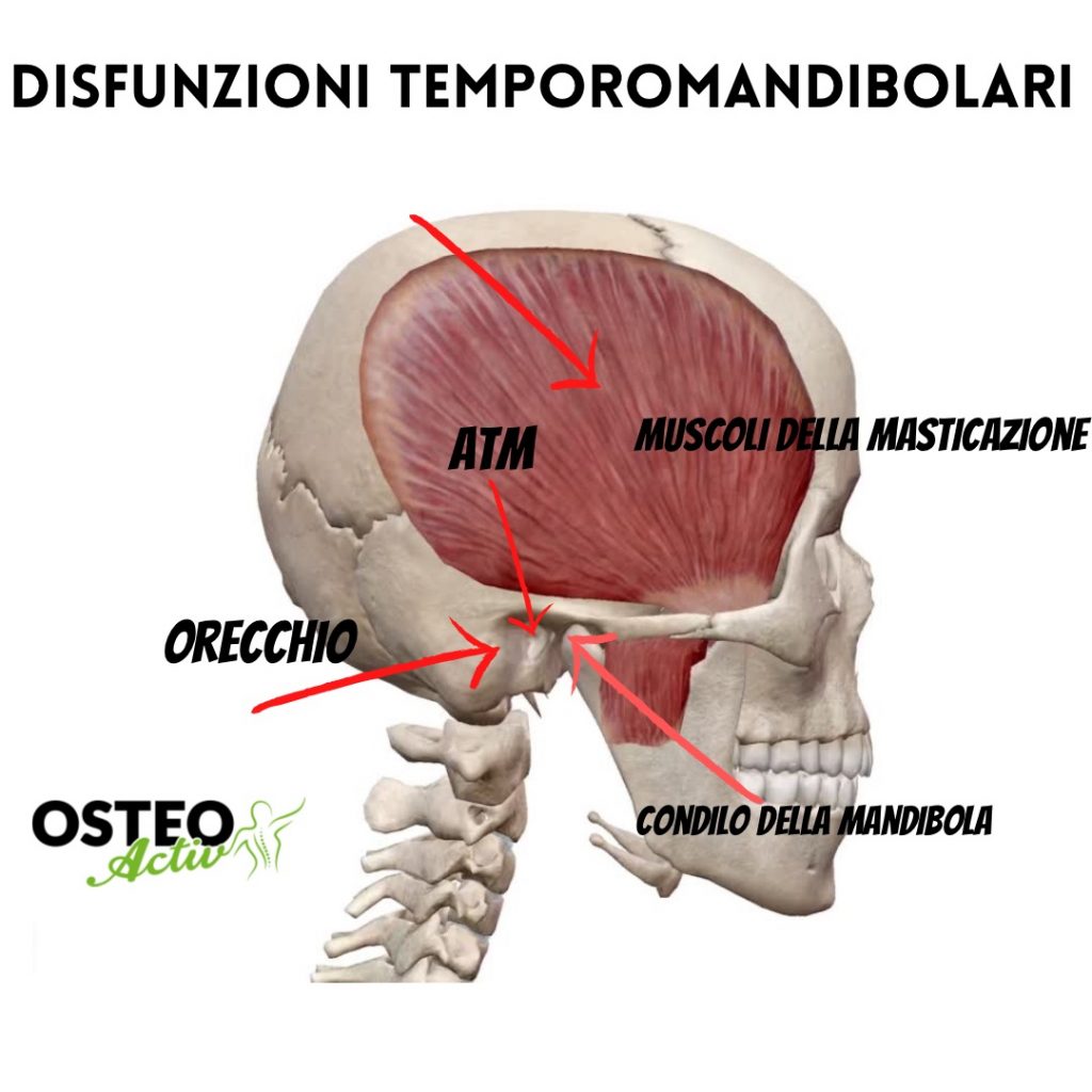 disordini temporo mandibolare trigemino