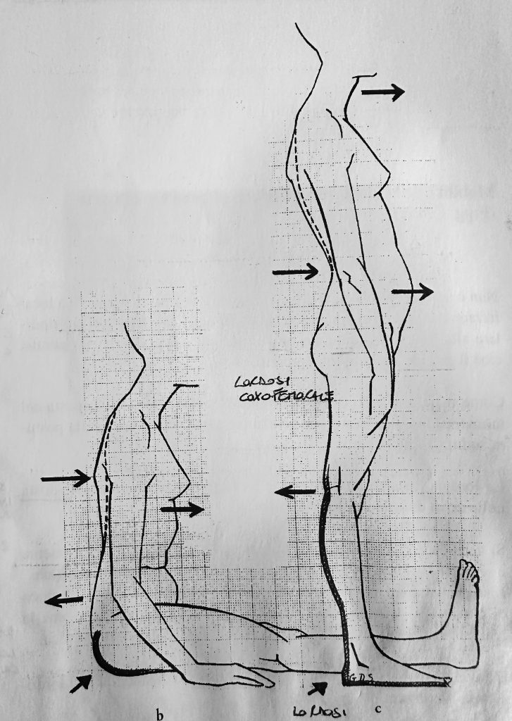 Lordosi coxo-femorale e recurvatum metodo Mézières