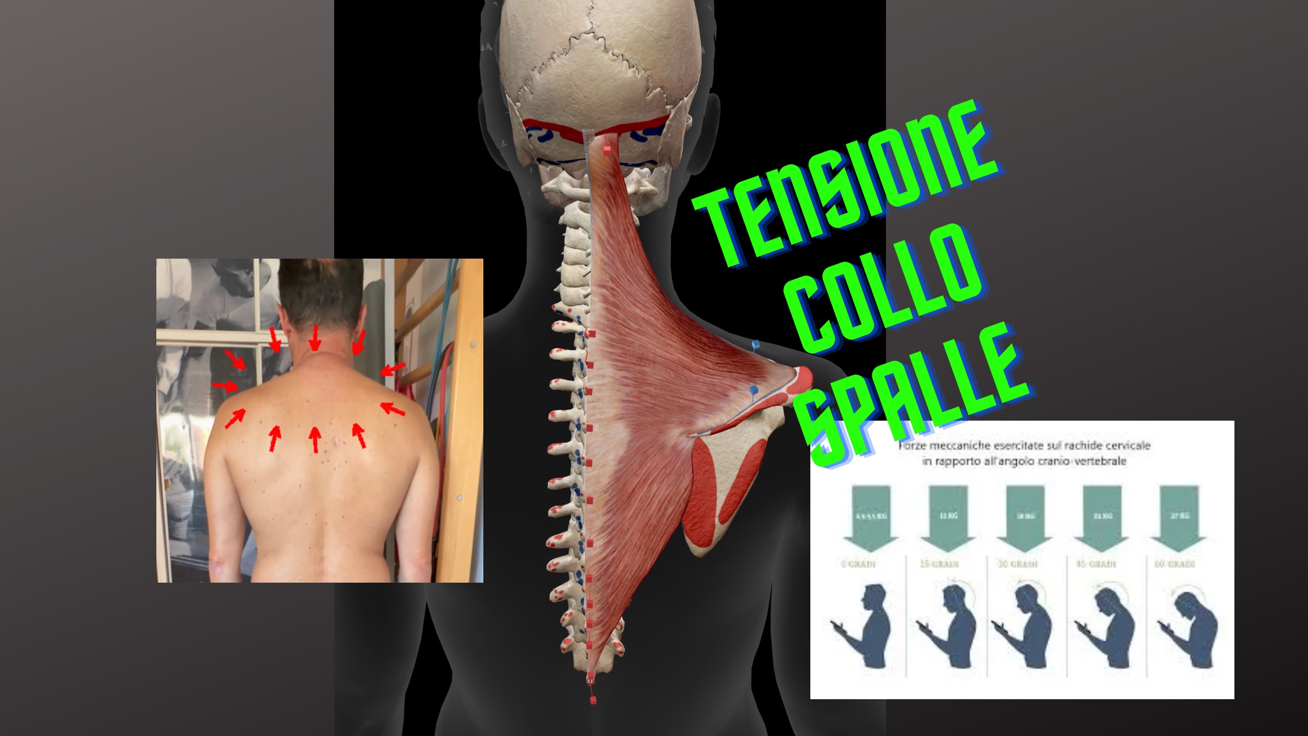 Tensione collo spalle trapezi cervicalgia