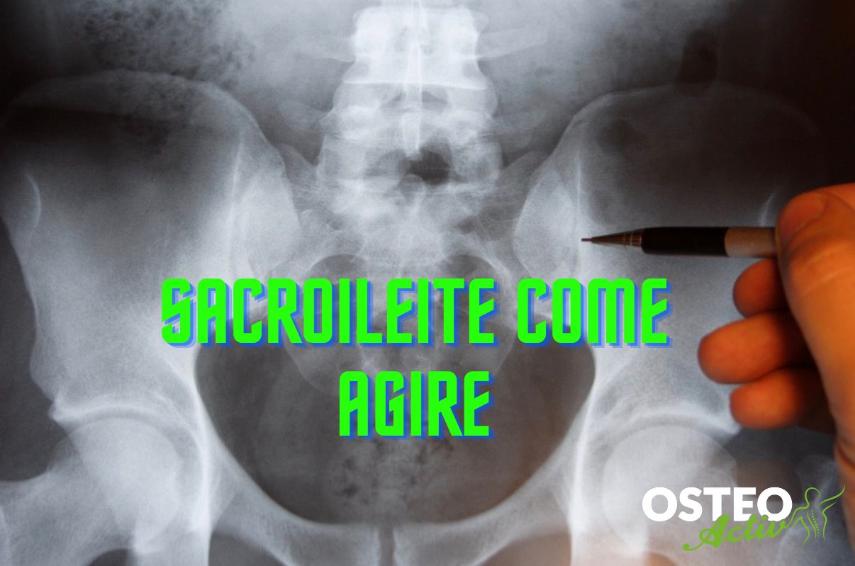 sacroileite cosa fare