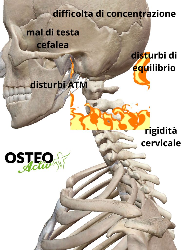 sintomi e dolore cervicale